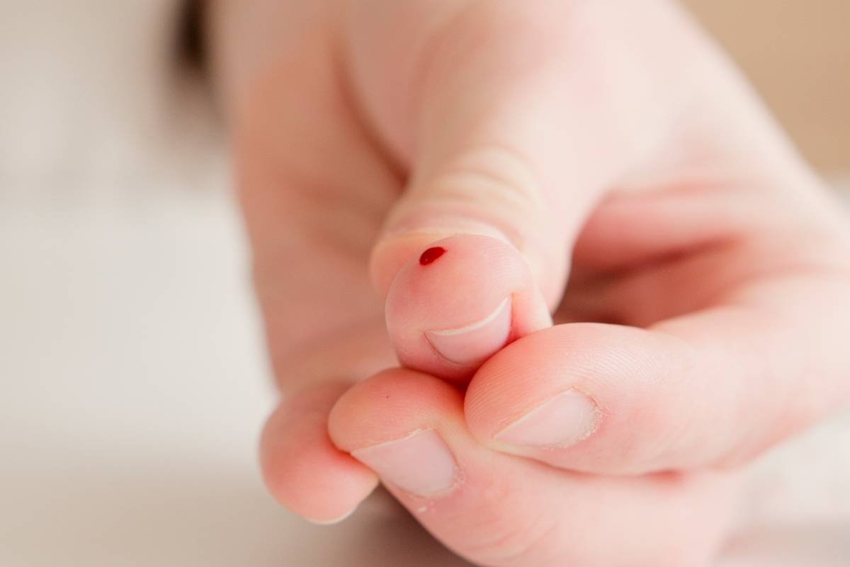 Hematofobia: miedo a la sangre. ¿Qué es y cómo afrontarla?